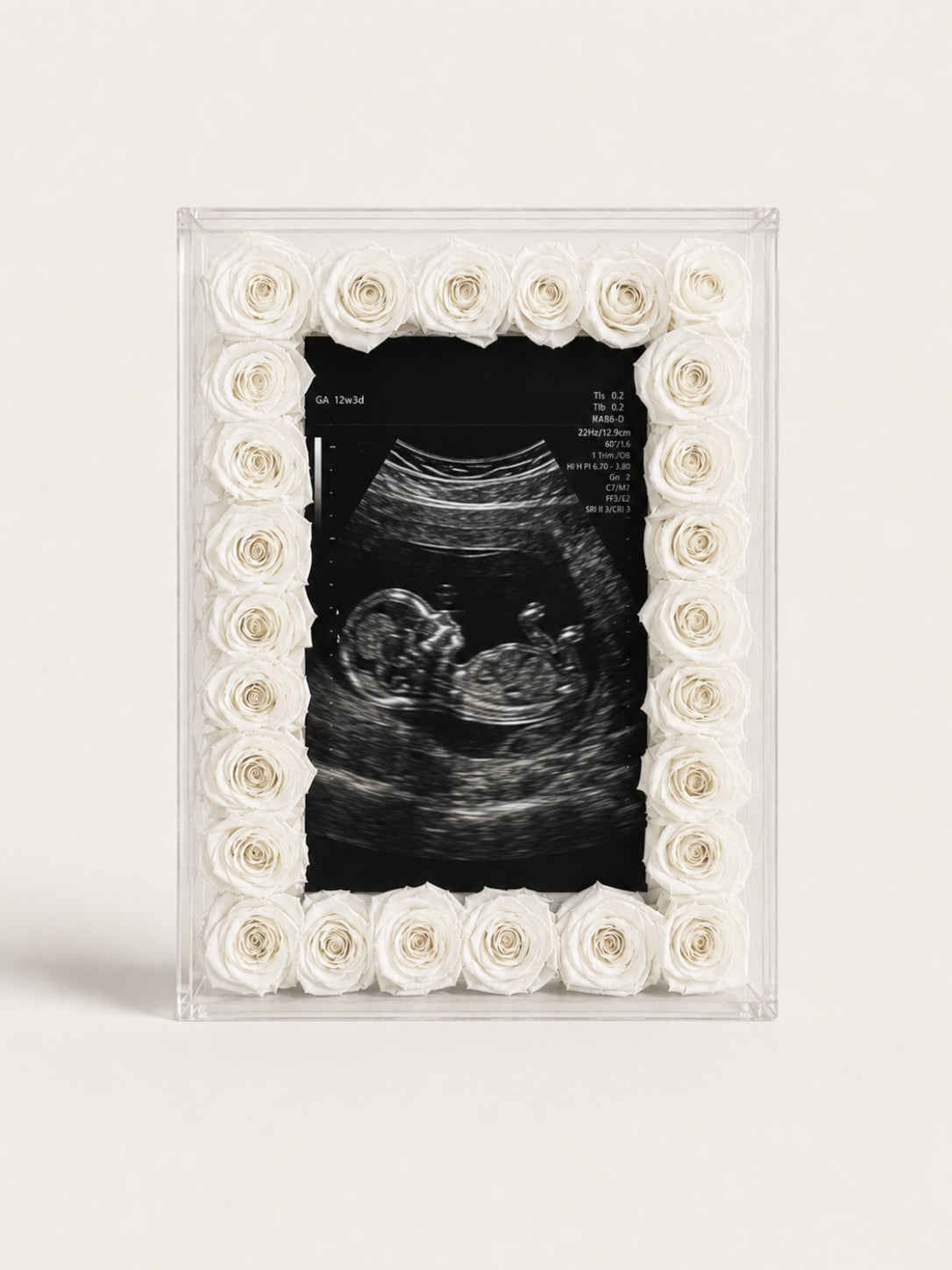Eternal Rose Frame